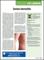 Contact Dermatitis